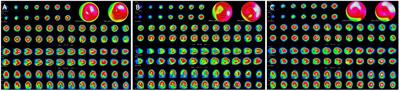 Nuclear Imaging in Pediatric Cardiology: Principles and Applications